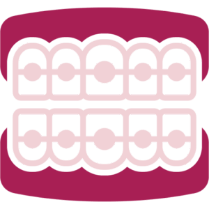 Ortodòncia invisible