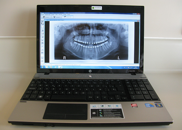 radiologia dental