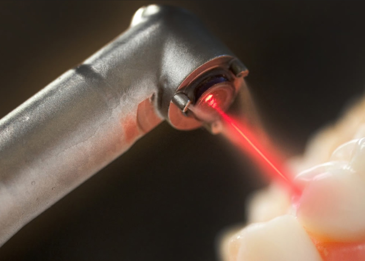 laser dental