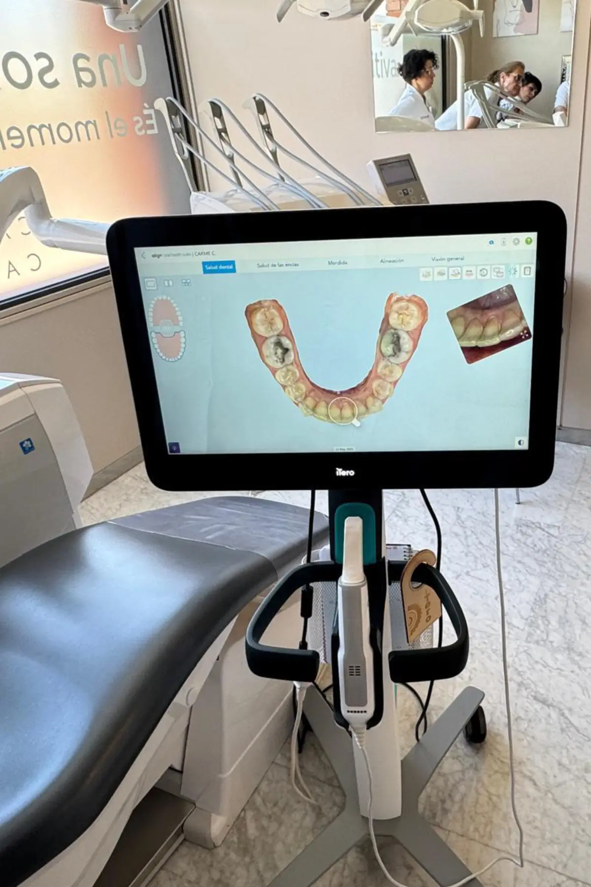 Diseño de la sonrisa – Clínica dental Doctora Minerva Diseño de la sonrisa - Clínica dental Doctora Minerva