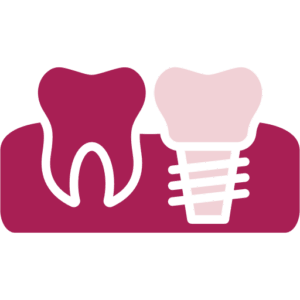Implants dentals 