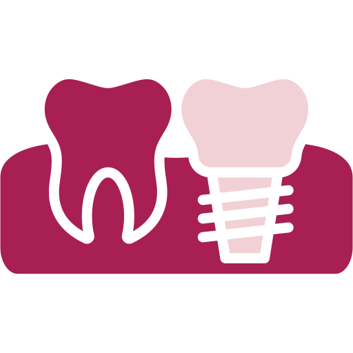 Implantes dentales 