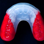 protector deportivo dental