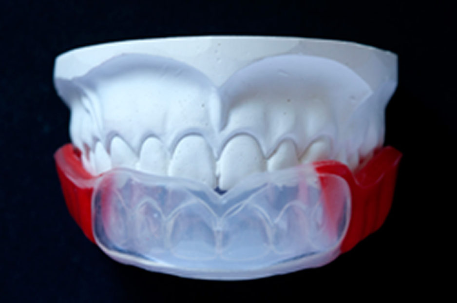protector dental deportivo
